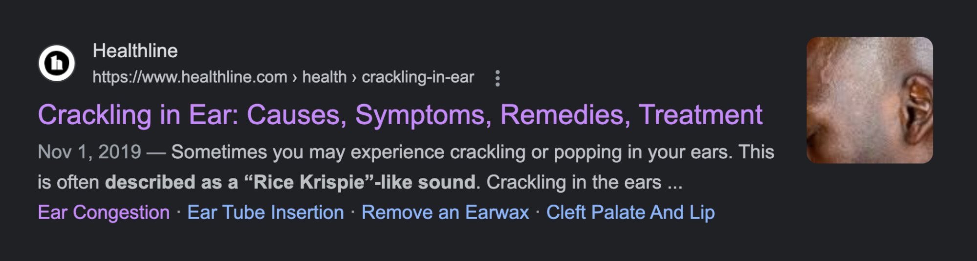 Crackling in ear search result

